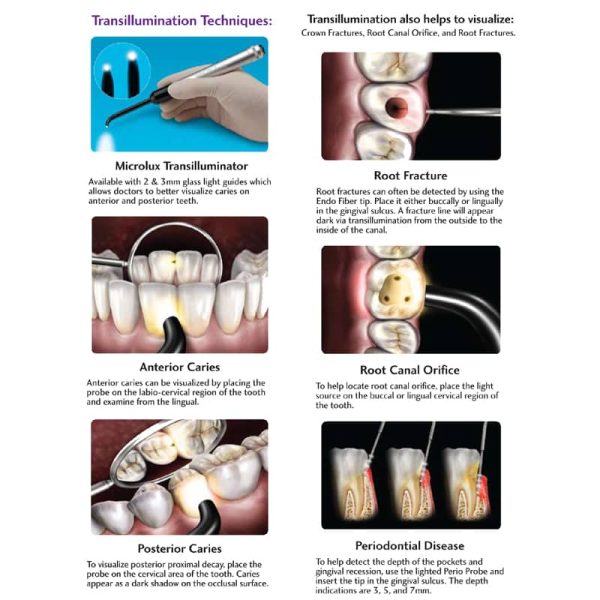 Surgery Transilluminator & Oral Cancer Adjuncts